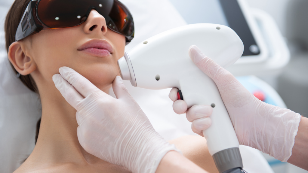 How Laser Treatments for Hyperpigmentation Can Help Achieve a More Balanced and Even Skin Tone